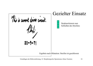 Gezielter Einsatz
Strukturelement zum
Schließen des Streifens

Ergebnis nach Dilatation: Streifen ist geschlossen
Grundlagen der Bildverarbeitung, 14. Morphologische Operationen, Klaus Toennies

10

 