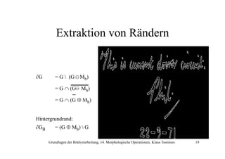 Extraktion von Rändern

∂G

= G  (G
(

Mb)

= G ∩ (G

Mb)

= G ∩ (G ⊕ Mb)
Hintergrundrand:
∂GB

= (G ⊕ Mb)  G
Grundlagen der Bildverarbeitung, 14. Morphologische Operationen, Klaus Toennies

19

 