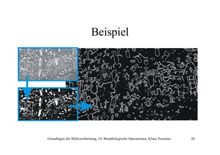 Beispiel

Grundlagen der Bildverarbeitung, 14. Morphologische Operationen, Klaus Toennies

20

 