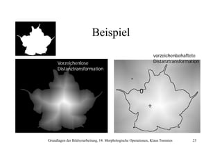 Beispiel
vorzeichenbehaftete
Distanztransformation

Vorzeichenlose
Distanztransformation

0

+

Grundlagen der Bildverarbeitung, 14. Morphologische Operationen, Klaus Toennies

23

 
