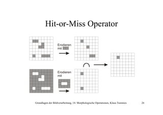 Hit-or-Miss Operator
Erodieren
mit

Erodieren
mit

Grundlagen der Bildverarbeitung, 14. Morphologische Operationen, Klaus Toennies

26

 