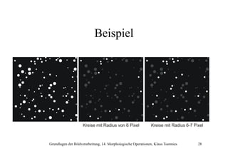 Beispiel

Kreise mit Radius von 6 Pixel

Kreise mit Radius 6-7 Pixel

Grundlagen der Bildverarbeitung, 14. Morphologische Operationen, Klaus Toennies

28

 