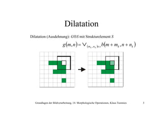 Dilatation
Dilatation (Ausdehnung): G⊕S mit Strukturelement S

g (m, n ) = ∨ (m k , n k )∈s b(m + mk , n + nk )

Grundlagen der Bildverarbeitung, 14. Morphologische Operationen, Klaus Toennies

3

 