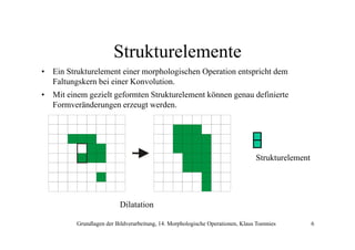 Strukturelemente
• Ein Strukturelement einer morphologischen Operation entspricht dem
Faltungskern bei einer Konvolution.
• Mit einem gezielt geformten Strukturelement können genau definierte
Formveränderungen erzeugt werden.

Strukturelement

Dilatation
Grundlagen der Bildverarbeitung, 14. Morphologische Operationen, Klaus Toennies

6

 