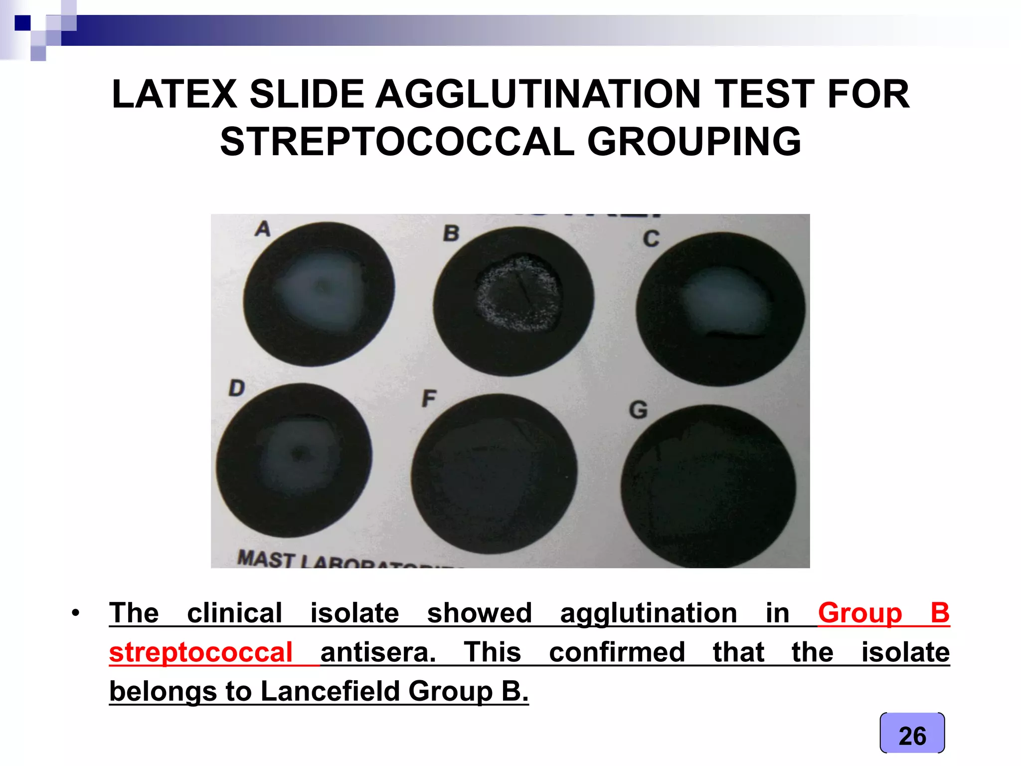 26
LATEX SLIDE AGGLUTINATION TEST FOR
STREPTOCOCCAL GROUPING
• The clinical isolate showed agglutination in Group B
streptococcal antisera. This confirmed that the isolate
belongs to Lancefield Group B.
 