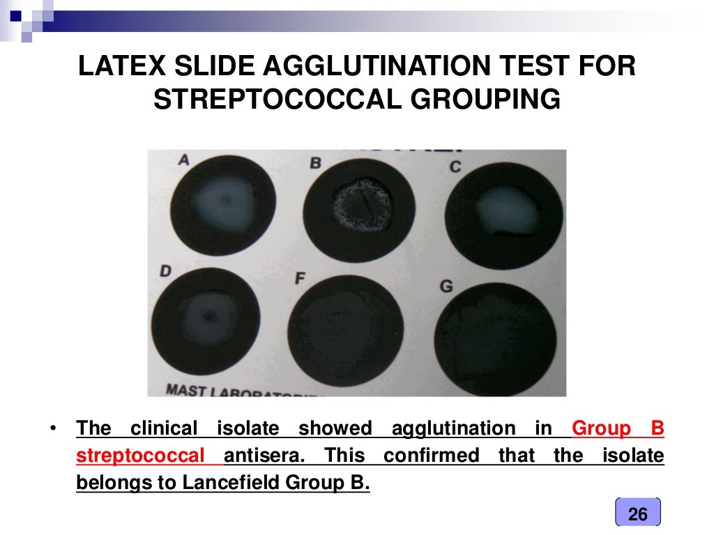 Medical Microbiology Laboratory (streptococcus spp.)