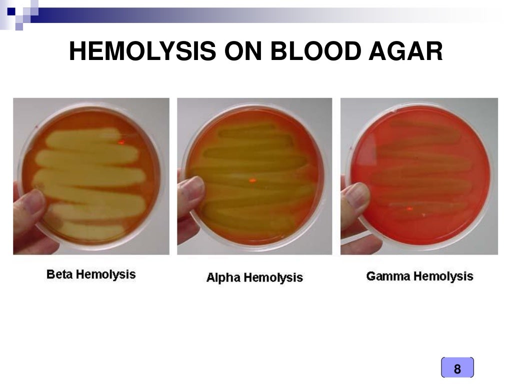 Medical Microbiology Laboratory (streptococcus spp.)