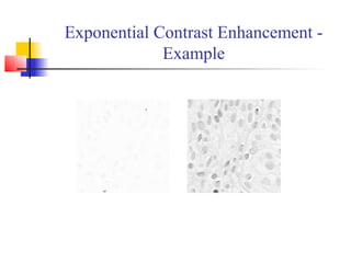 Exponential Contrast Enhancement -
Example
 