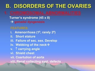 B. DISORDERS OF THE OVARIES
1. CHROMOSOMAL ABNORMALITIES
Turner’s syndrome (45 x 0)
 gonadal dysgenesis
FEATURES:
i. Amenorrhoea (10, rarely 20)
ii. Short stature
iii. Failure of sec. sex. Develop
iv. Webbing of the neck
v.  carrying angle
vi. Shield chest
vii. Coartution of aorta
viii. Renal collecting syst. defects
 