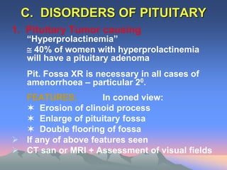 C. DISORDERS OF PITUITARY
1. Pituitary Tumor causing
“Hyperprolactinemia”
 40% of women with hyperprolactinemia
will have a pituitary adenoma
Pit. Fossa XR is necessary in all cases of
amenorrhoea – particular 20.
FEATURES: In coned view:
 Erosion of clinoid process
 Enlarge of pituitary fossa
 Double flooring of fossa
 If any of above features seen
 CT san or MRI + Assessment of visual fields
 