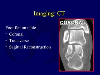 Imaging: CT
Foot flat on table
• Coronal
• Transverse
• Sagittal Reconstruction
CORONALCORONAL
 