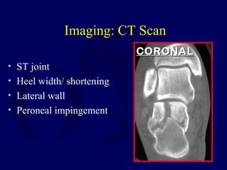 Imaging: CT Scan
• ST joint
• Heel width/ shortening
• Lateral wall
• Peroneal impingement
CORONALCORONAL
 