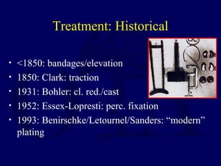 Treatment: Historical
• <1850: bandages/elevation
• 1850: Clark: traction
• 1931: Bohler: cl. red./cast
• 1952: Essex-Lopresti: perc. fixation
• 1993: Benirschke/Letournel/Sanders: “modern”
plating
 