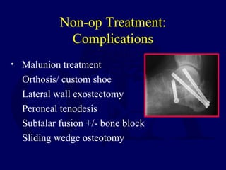 Non-op Treatment:
Complications
• Malunion treatment
Orthosis/ custom shoe
Lateral wall exostectomy
Peroneal tenodesis
Subtalar fusion +/- bone block
Sliding wedge osteotomy
 