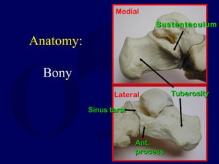 Anatomy:
Bony
SustentaculumSustentaculum
Medial
Lateral
Ant.Ant.
processprocess
TuberosityTuberosity
Sinus tarsiSinus tarsi
 