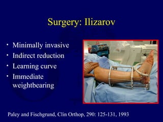 Surgery: Ilizarov
• Minimally invasive
• Indirect reduction
• Learning curve
• Immediate
weightbearing
Paley and Fischgrund, Clin Orthop, 290: 125-131, 1993
 