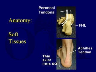 Anatomy:
Soft
Tissues
FHL
Peroneal
Tendons
Achilles
Tendon
ThinThin
skin/skin/
little SQlittle SQ
 