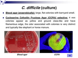 Medical Microbiology Laboratory (Clostridium spp.) | PDF