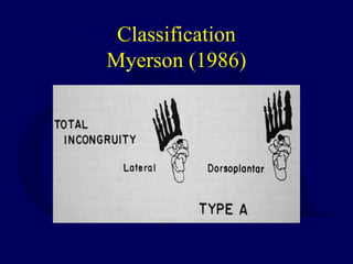 L16 lisfranc & midfoot inj | PPT