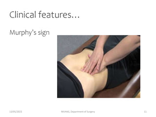 Clinical features…
Murphy’s sign
13/05/2023 MUHAS, Department of Surgery 11
 