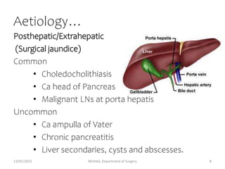Aetiology…
Posthepatic/Extrahepatic
(Surgical jaundice)
Common
• Choledocholithiasis
• Ca head of Pancreas
• Malignant LNs at porta hepatis
Uncommon
• Ca ampulla of Vater
• Chronic pancreatitis
• Liver secondaries, cysts and abscesses.
13/05/2023 MUHAS, Department of Surgery 8
 