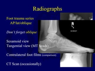 Radiographs
Foot trauma series
AP/lat/oblique
Don’t forget oblique
Sesamoid view
Tangential view (MT heads)
Contralateral foot films (comparison)
CT Scan (occasionally)
 