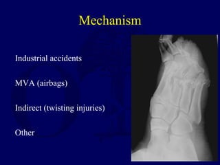 Mechanism
Industrial accidents
MVA (airbags)
Indirect (twisting injuries)
Other
 