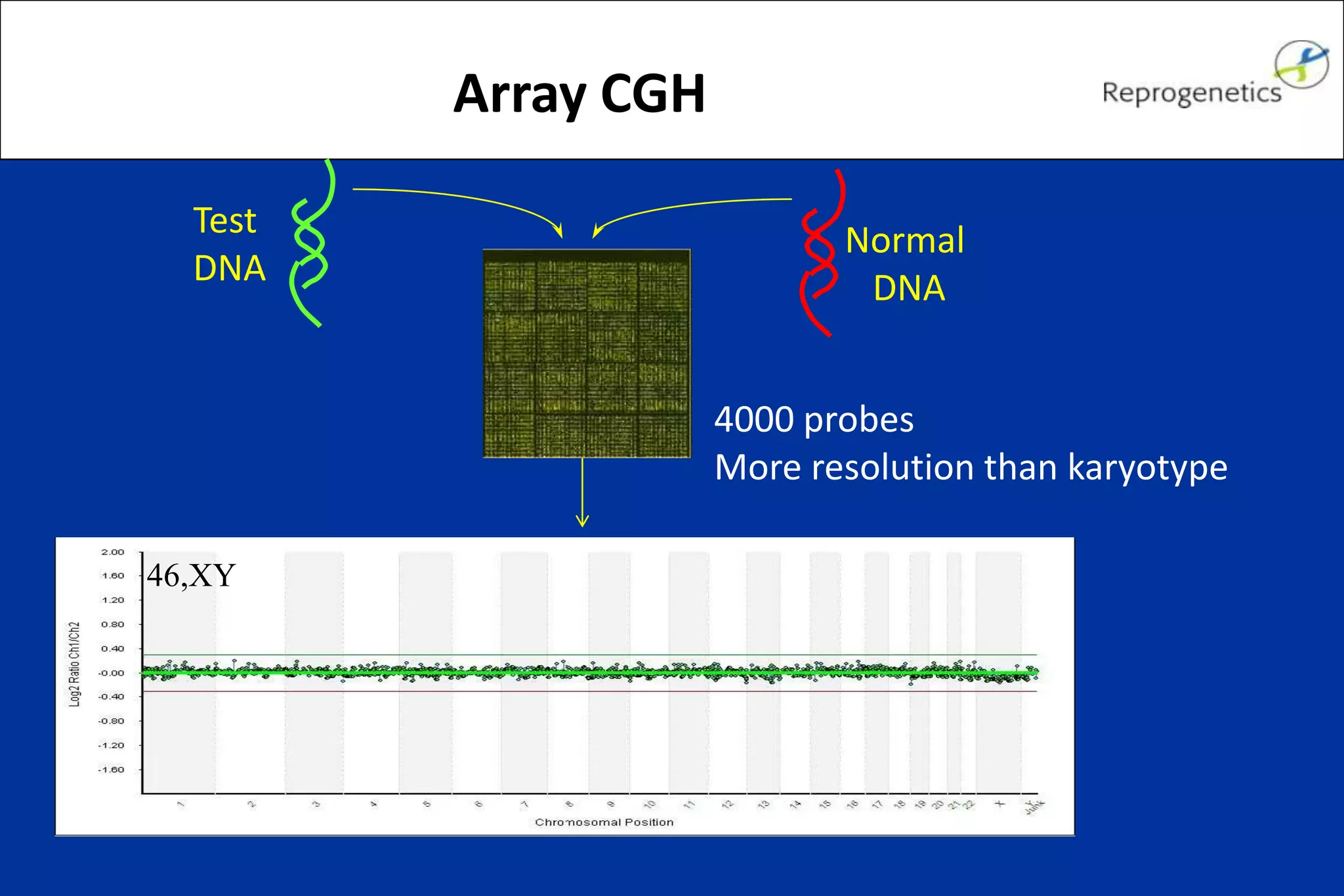 Array CGH
Test
DNA
Normal
DNA
4000 probes
More resolution than karyotype
46,XY
 