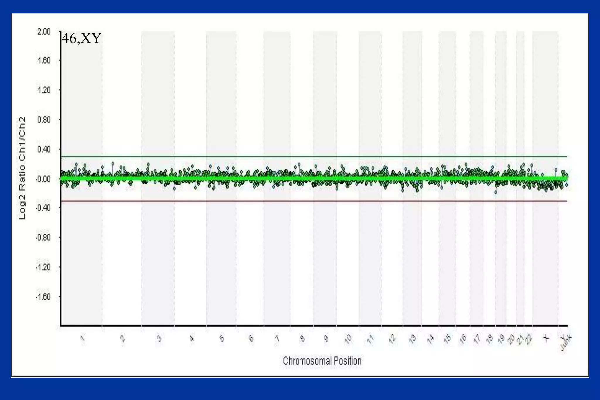 46,XY
 