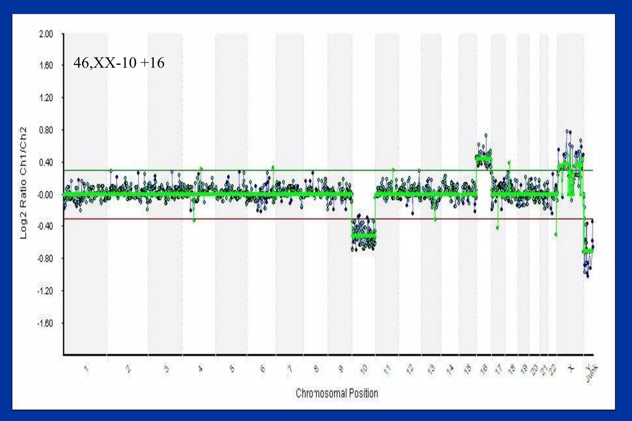 46,XX-10 +16
 
