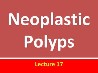 Neoplastic
Polyps
Lecture 17
 