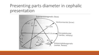 Presenting parts diameter in cephalic
presentation
 