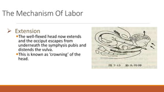 The Mechanism Of Labor
 Extension
The well-flexed head now extends
and the occiput escapes from
underneath the symphysis pubis and
distends the vulva.
This is known as ‘crowning’ of the
head.
 