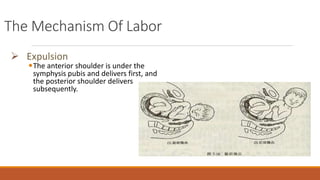 The Mechanism Of Labor
 Expulsion
The anterior shoulder is under the
symphysis pubis and delivers first, and
the posterior shoulder delivers
subsequently.
 