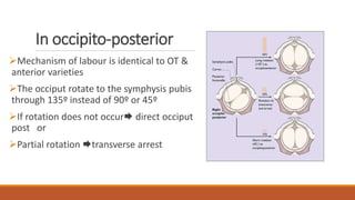 In occipito-posterior
Mechanism of labour is identical to OT &
anterior varieties
The occiput rotate to the symphysis pubis
through 135º instead of 90º or 45º
If rotation does not occur direct occiput
post or
Partial rotation transverse arrest
 