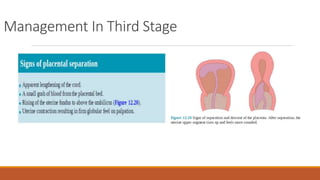 Management In Third Stage
 