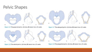 Pelvic Shapes
 