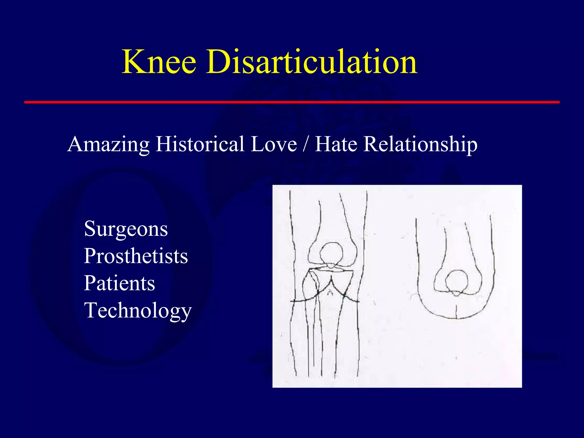 Knee Disarticulation
Amazing Historical Love / Hate Relationship
Surgeons
Prosthetists
Patients
Technology
 