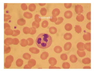 Neutrophil
 