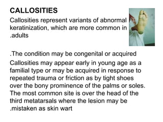 Callosities Dermatology 5th year, 2nd lecture (Dr. Kazhan) | PPT