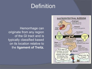 Definition
Hemorrhage can
originate from any region
of the GI tract and is
typically classified based
on its location relative to
the ligament of Treitz.
 