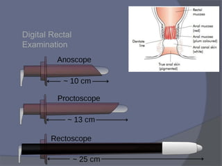 Digital Rectal
Examination
 