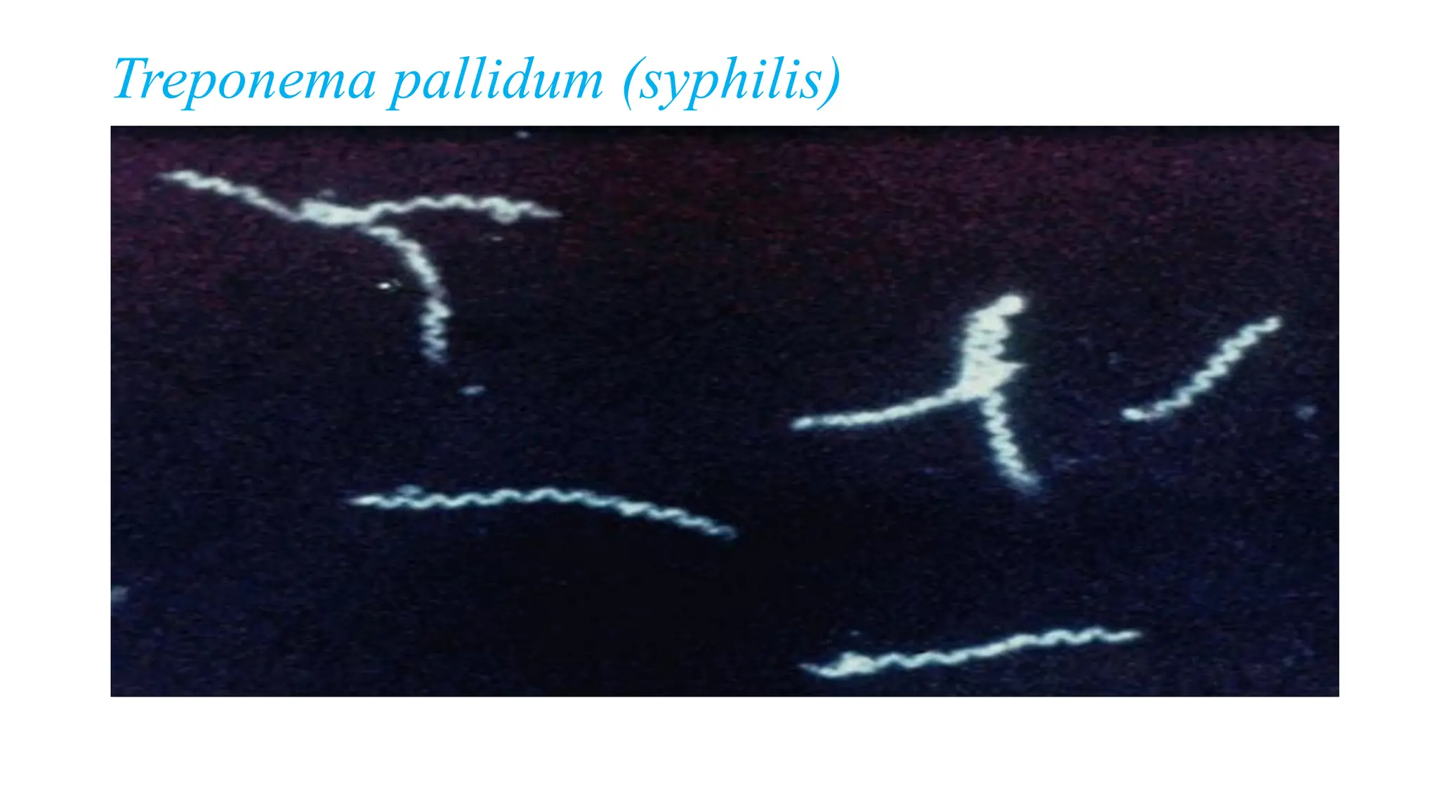 Treponema pallidum (syphilis)
 