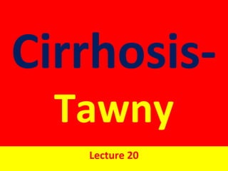 Cirrhosis-
Tawny
Lecture 20
 