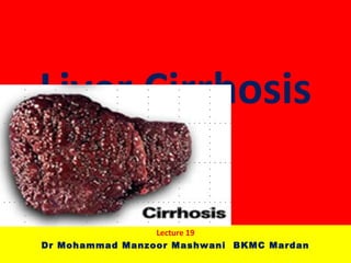 Liver Cirrhosis
Lecture 19
Dr Mohammad Manzoor Mashwani BKMC Mardan
 