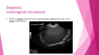 Diagnosis
transvaginal ultrasound
 Useful in ovarian endometrioma as ground glass appearance cyst and in
rectal endometriosis
 