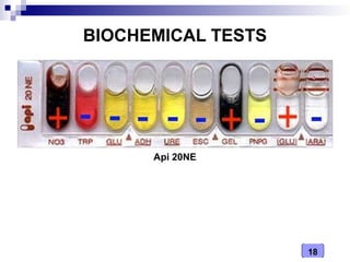 Medical Microbiology Laboratory (Vibrio spp.) | PDF