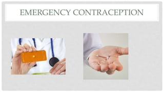 EMERGENCY CONTRACEPTION
 