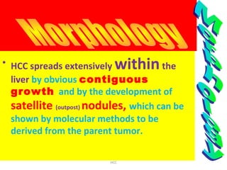 • HCC spreads extensively withinthe
liver by obvious contiguous
growth and by the development of
satellite (outpost) nodules, which can be
shown by molecular methods to be
derived from the parent tumor.
HCC
 