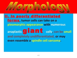 II. In poorly differentiated
forms, tumor cells can take on a
pleomorphic appearance with numerous
anaplastic giant cells, can be small
and completely undifferentiated, or may
even resemble a spindle cell sarcoma.
HCC
 